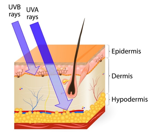 Sun Damage & the Importance of Sunscreen | Rodan + Fields®