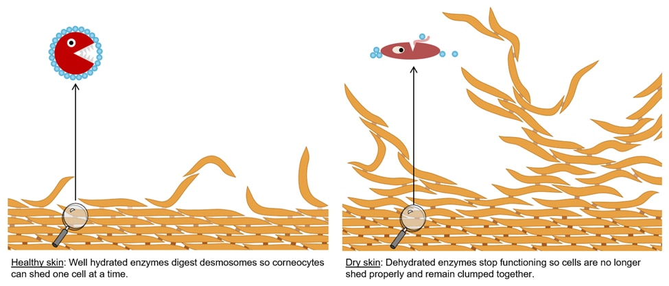 Diagram contrasting healthy skin vs dry skin. In healthy skin, well-hydrated enzymes digest desmosomes so corneocytes can shed one cell at a time. In dry skin, dehydrated enzymes stop functioning so cells are no longer shed properly and remain clumped together.