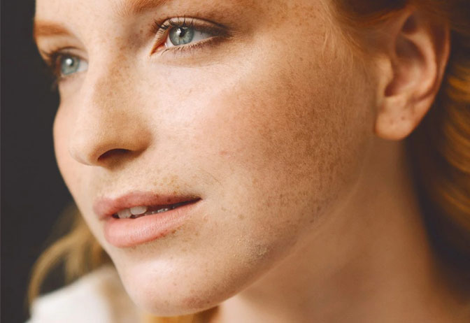 Young woman with freckles. Young woman with freckles.